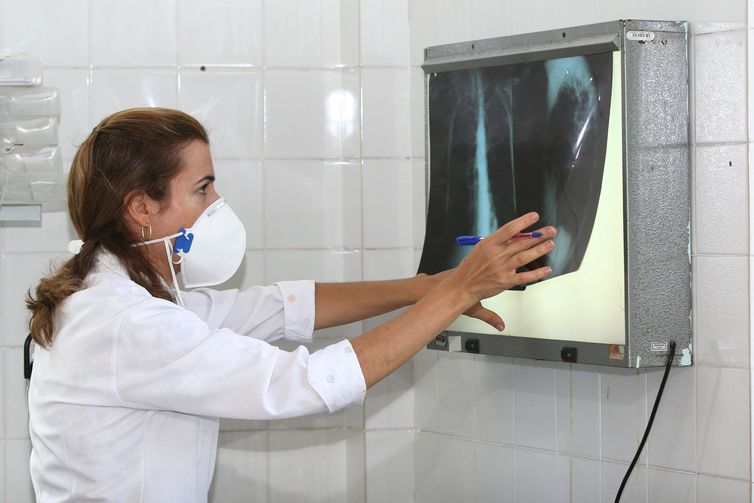 Estudo apoiado pela Fapeam caracteriza inflamações relacionadas à tuberculose Estudo apoiado pela Fapeam caracteriza inflamações relacionadas à tuberculose