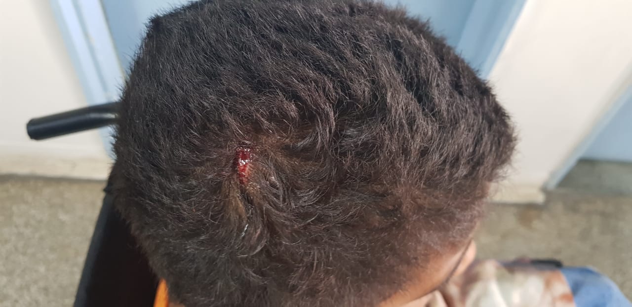 Mulher é presa após agredir com golpes de faca o próprio filho de 6 anos Mulher é presa após agredir com golpes de faca o próprio filho de 6 anos