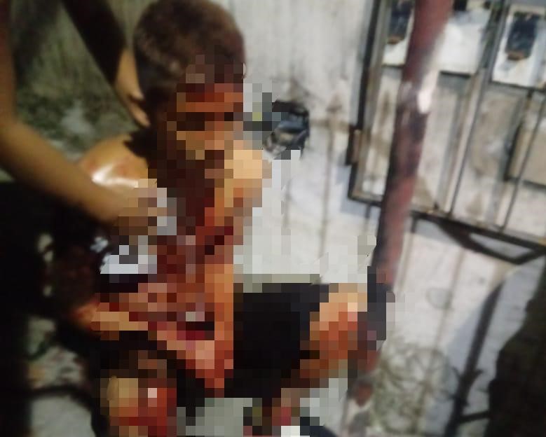 Vestidos de preto, suspeitos atiram em homem em tentativa de homicídio na Betânia Vestidos de preto, suspeitos atiram em homem em tentativa de homicídio na Betânia