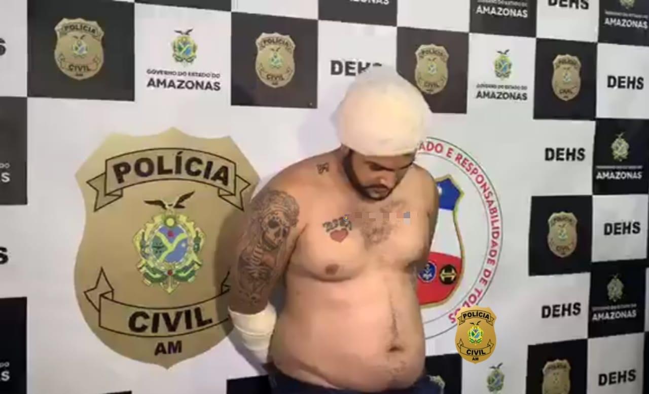 Baleado, suspeito de matar homem em hospital &eacute; preso ao procurar 28 de Agosto