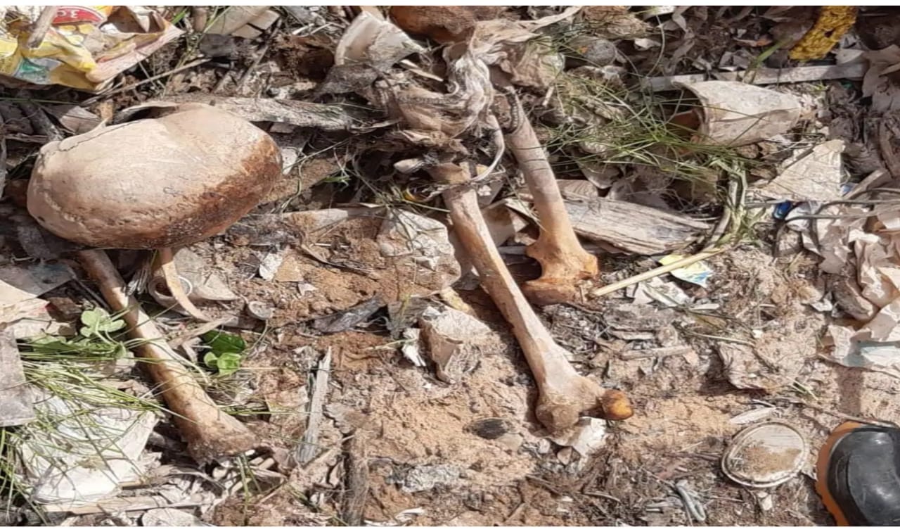 ENCONTRO MACABRO Durante limpeza na orla, garis acham crânio humano ENCONTRO MACABRO Durante limpeza na orla, garis acham crânio humano