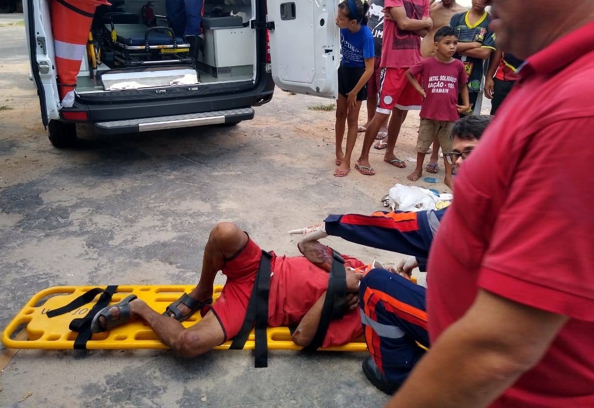 Morador de rua dorme embaixo de caminh&atilde;o e acaba atropelado no S&atilde;o Jos&eacute;