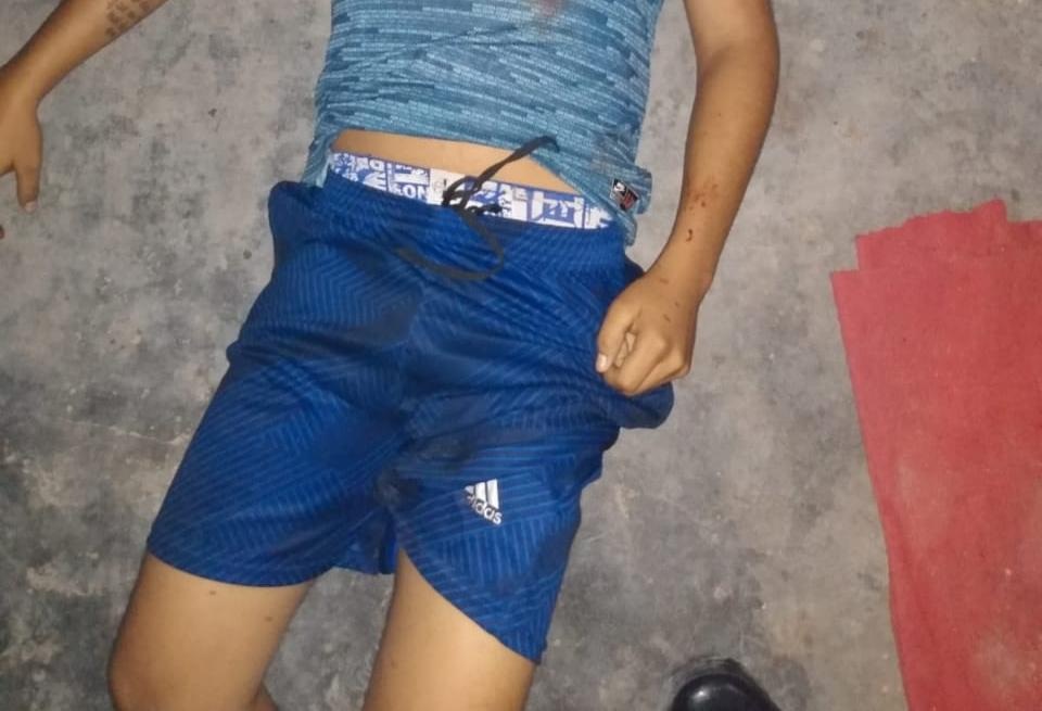 'Bactéria' tenta fugir da morte, mas é assassinado com 4 tiros no Jorge Teixeira 'Bactéria' tenta fugir da morte, mas é assassinado com 4 tiros no Jorge Teixeira