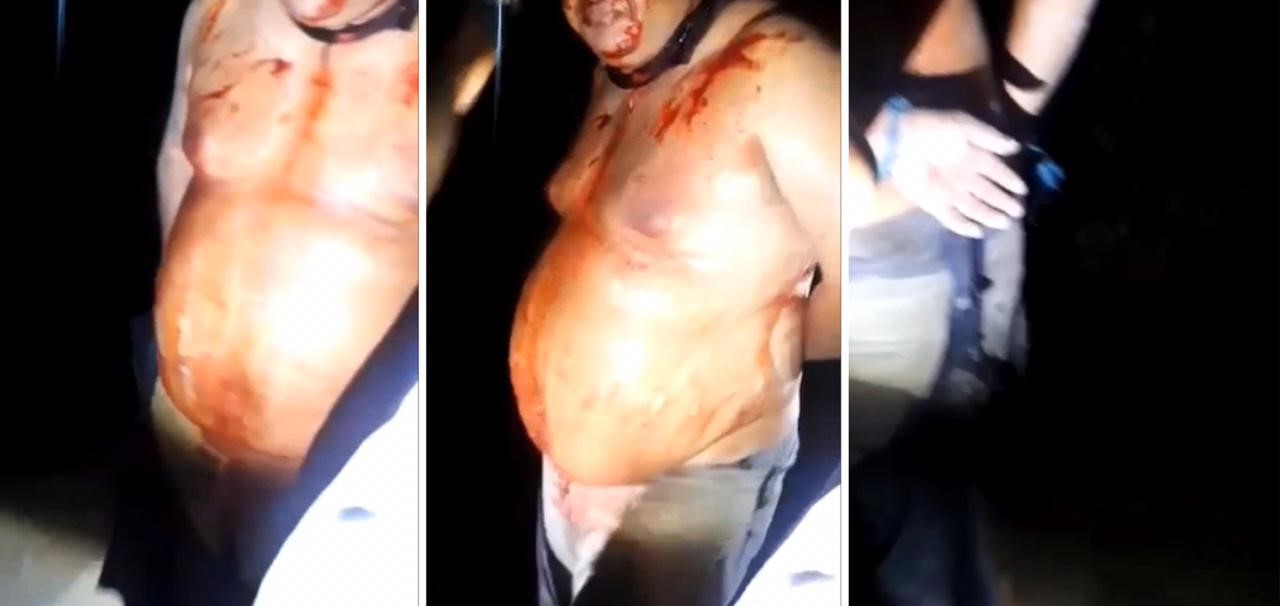 Líder comunitário escapa da morte no Nova Cidade; ele estava amarrado para o 'Tribunal do Crime' Líder comunitário escapa da morte no Nova Cidade; ele estava amarrado para o 'Tribunal do Crime'