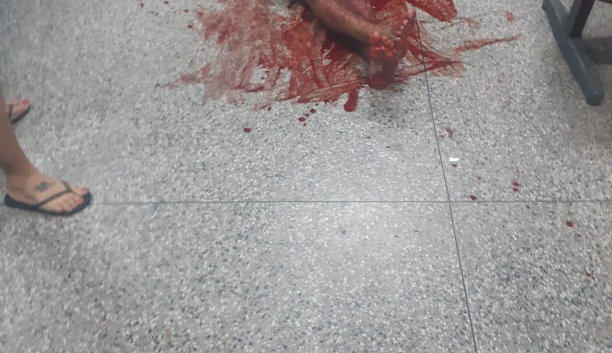 Esfaqueado e sangrando, homem corre para delegacia no São José e pede socorro Esfaqueado e sangrando, homem corre para delegacia no São José e pede socorro