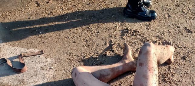 Quase linchado, homem é internado após apanhar; ele foi flagrado tentando estuprar criança Quase linchado, homem é internado após apanhar; ele foi flagrado tentando estuprar criança