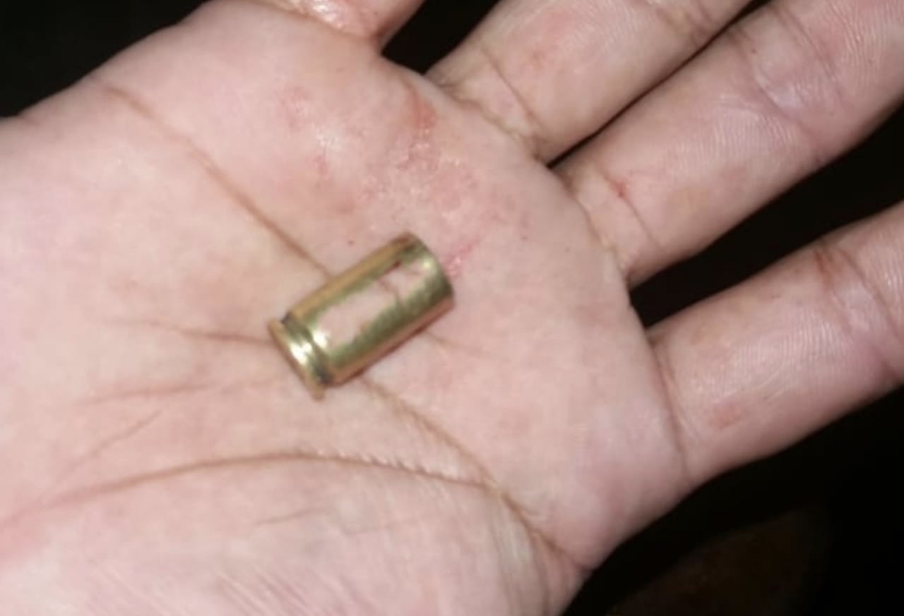 Sargento da PM foi um dos feridos em tiroteio na Cachoeirinha Sargento da PM foi um dos feridos em tiroteio na Cachoeirinha