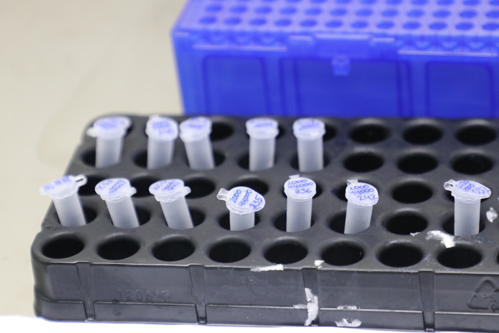Amazonas passa a realizar o diagnóstico de Covid-19 em laboratório Amazonas passa a realizar o diagnóstico de Covid-19 em laboratório