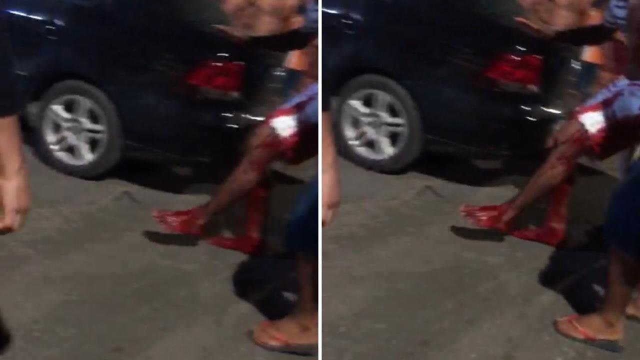 Tiroteio na Compensa deixa criança de 12 anos baleada. Veja vídeo Tiroteio na Compensa deixa criança de 12 anos baleada. Veja vídeo