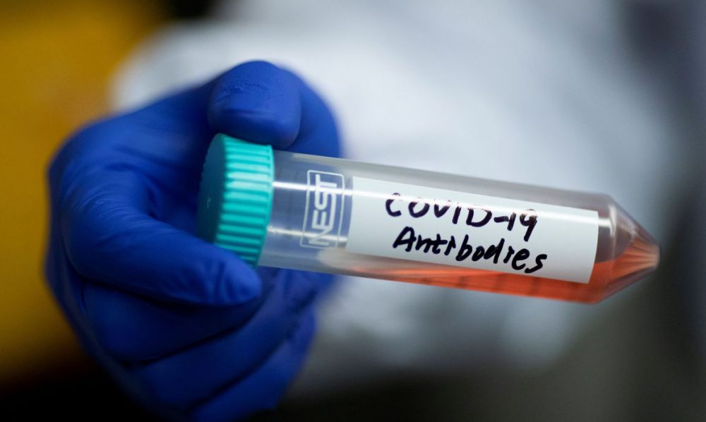 Estado tem 16 óbitos novos por Covid-19 e chega a 106 mortes confirmadas; letalidade no AM é de 6,8% Estado tem 16 óbitos novos por Covid-19 e chega a 106 mortes confirmadas; letalidade no AM é de 6,8%