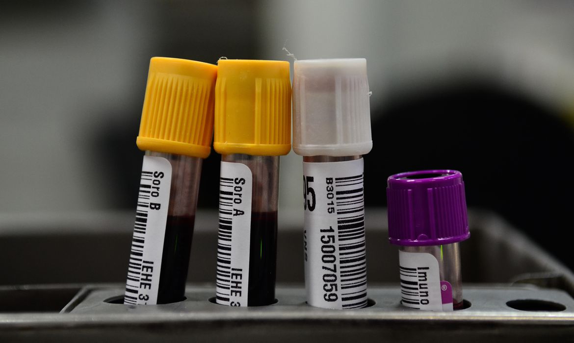 Hemorio inicia testes com plasma sanguíneo no tratamento de Covid-19 Hemorio inicia testes com plasma sanguíneo no tratamento de Covid-19