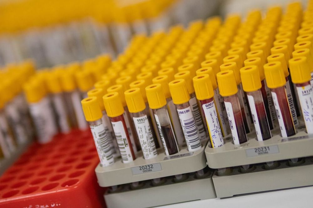 AM chega a 90 óbitos confirmados por Covid-19 e taxa de letalidade é de 6% AM chega a 90 óbitos confirmados por Covid-19 e taxa de letalidade é de 6%