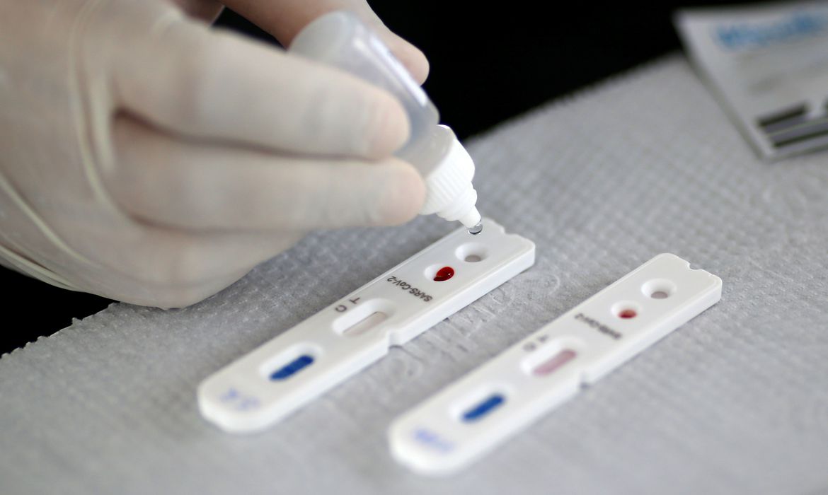 Brit&acirc;nicos que produzem vacina far&atilde;o testes com 10 mil pessoas