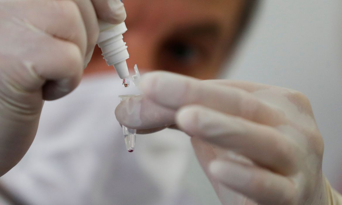 Covid-19: Brasil tem quase 500 mil casos confirmados e 28.834 mortes Covid-19: Brasil tem quase 500 mil casos confirmados e 28.834 mortes