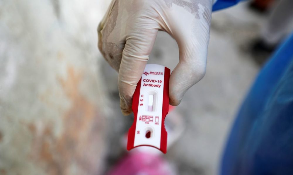 Brasil anuncia parceria para produzir 100 milhões de doses de vacina contra vírus Brasil anuncia parceria para produzir 100 milhões de doses de vacina contra vírus