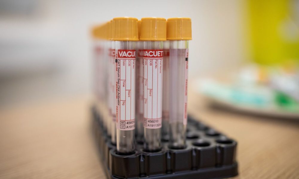 Brasil registra 552 óbitos e 30.476 novos casos; AM é o sexto em infectados Brasil registra 552 óbitos e 30.476 novos casos; AM é o sexto em infectados