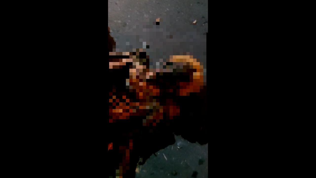 Homem é detido após desenterrar cadáver de avó de cemitério e dançar com ele no Morro da Liberdade Homem é detido após desenterrar cadáver de avó de cemitério e dançar com ele no Morro da Liberdade