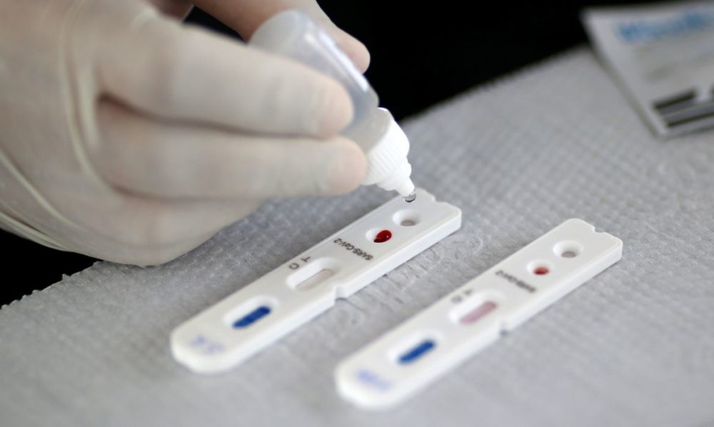 Saiba como funcionam os testes para detectar Covid-19 Saiba como funcionam os testes para detectar Covid-19