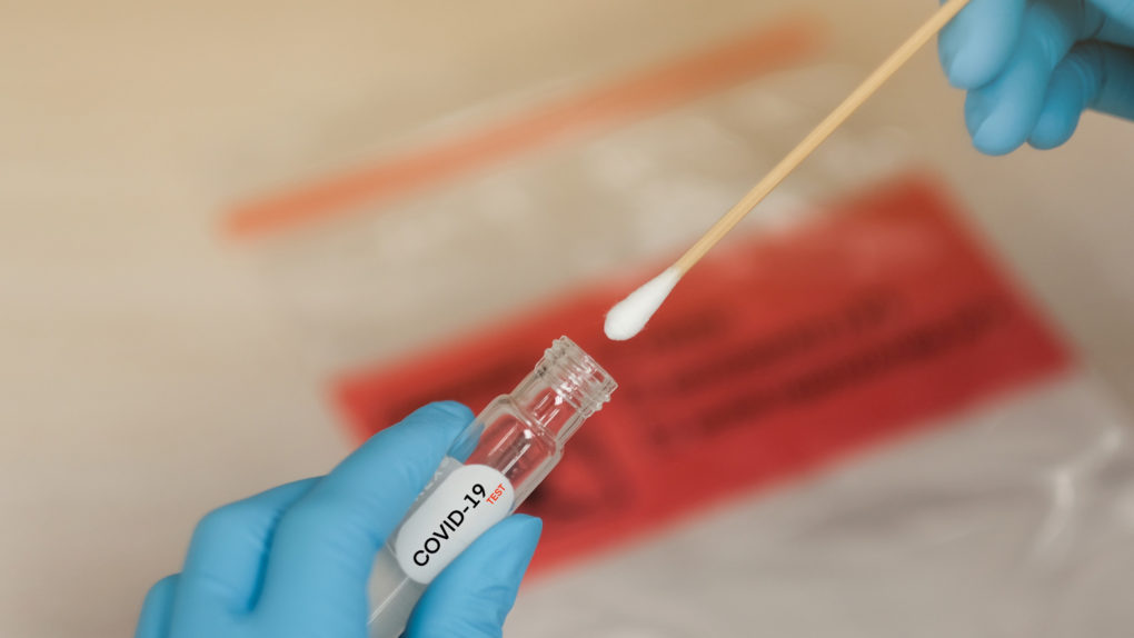 Teste identifica assintom&aacute;ticos de Covid-19 pela saliva