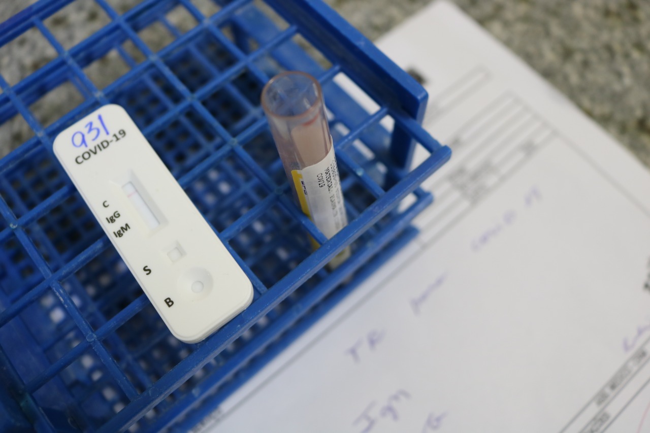 Pacientes oncológicos são testados para Covid-19 antes de cirurgias eletivas na FCecon Pacientes oncológicos são testados para Covid-19 antes de cirurgias eletivas na FCecon