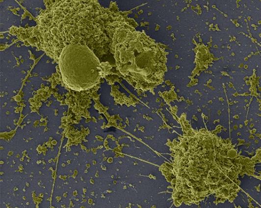 Pesquisadores registram efeitos da infecção pelo Covid-19 nas células Pesquisadores registram efeitos da infecção pelo Covid-19 nas células