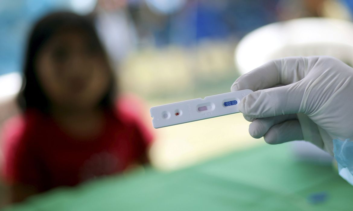 Com 658 novos casos de Covid-19, AM totaliza 177.800 infectados na pandemia Com 658 novos casos de Covid-19, AM totaliza 177.800 infectados na pandemia