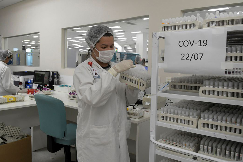 Com menos de 500 casos novos, AM passa de 324 mil infectados neste domingo Com menos de 500 casos novos, AM passa de 324 mil infectados neste domingo