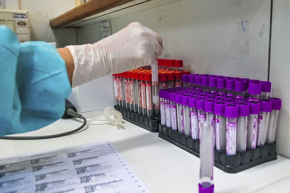 AM chega a 305 mil casos e apenas 9 municípios atualizam dados da Covid neste sábado AM chega a 305 mil casos e apenas 9 municípios atualizam dados da Covid neste sábado
