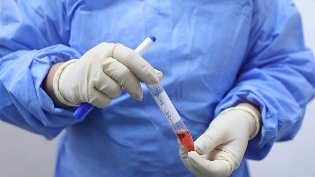 AM passa de 371 mil casos de coronav&iacute;rus e tem mais de 40 mil em tratamento