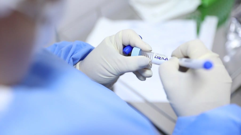 BRASIL: Casos de coronav&iacute;rus crescem 3% e mortes caem 11%