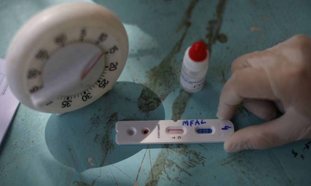 Pesquisa testará presença de anticorpos em 211 mil pessoas Pesquisa testará presença de anticorpos em 211 mil pessoas