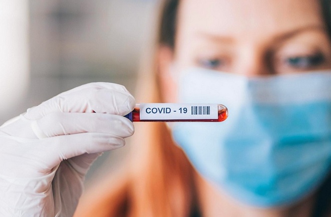 Oito cidades do AM participam de mapeamento da Covid no Brasil