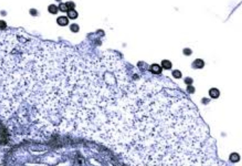 Pandemia: Estudo analisa mortalidade precoce em UTIs ligada a retrovírus ancestral Pandemia: Estudo analisa mortalidade precoce em UTIs ligada a retrovírus ancestral