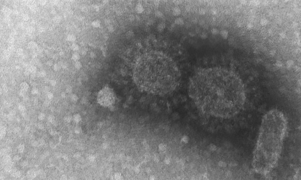 Pandemia: Campinas impõe toque de recolher e fechamento de comércio Pandemia: Campinas impõe toque de recolher e fechamento de comércio