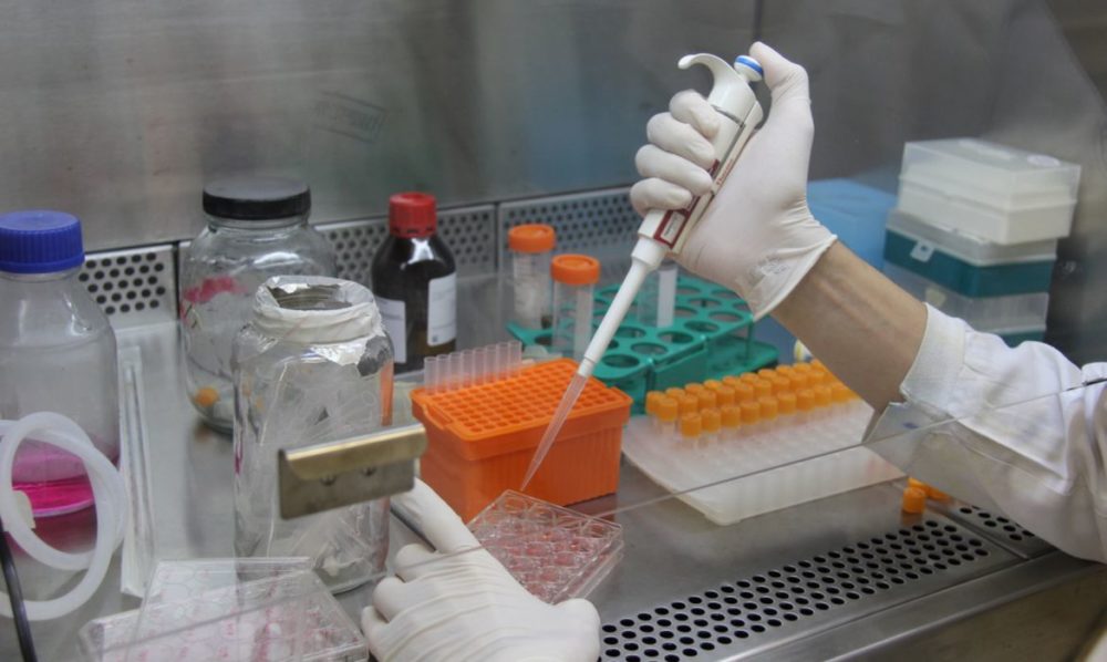 Pesquisadores desenvolvem testes rápidos para diagnóstico de Covid Pesquisadores desenvolvem testes rápidos para diagnóstico de Covid