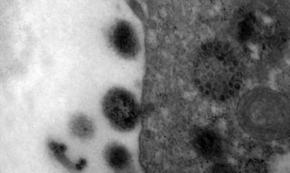 Covid: anticorpos podem durar at&eacute; 12 meses ap&oacute;s infec&ccedil;&atilde;o