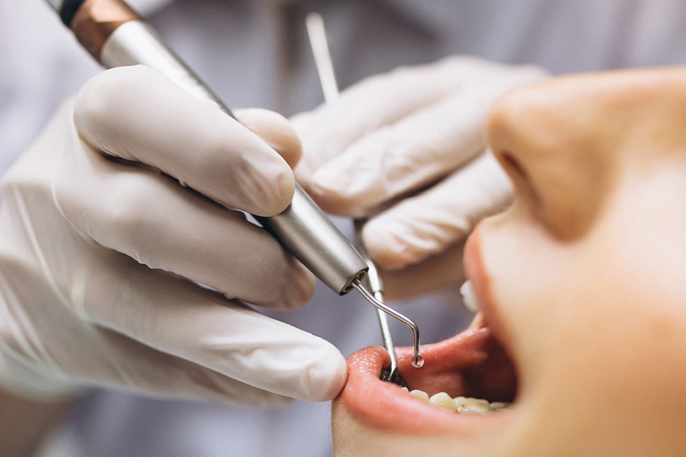 Ministério da Saúde destina R$ 1,7 milhão para atendimentos odontológicos pelo SUS