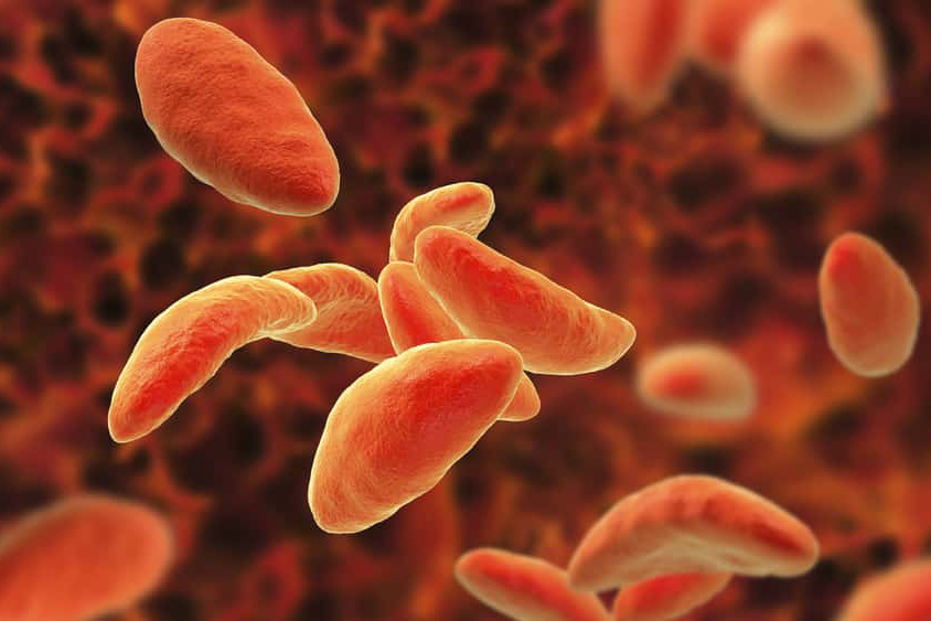 Saúde: saiba o que é a toxoplasmose, sintomas e tratamento Saúde: saiba o que é a toxoplasmose, sintomas e tratamento