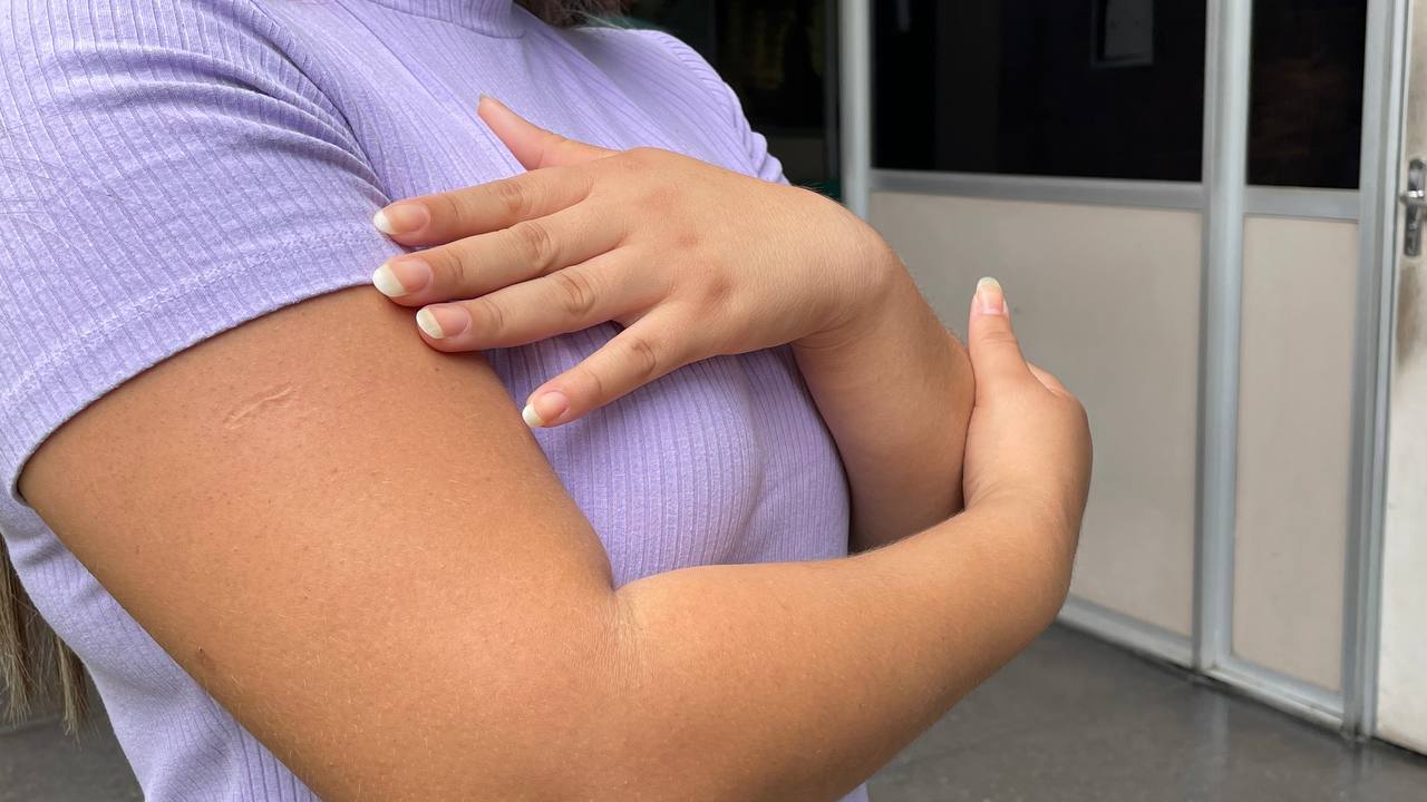 Campanha Fevereiro Roxo alerta para lúpus, fibromialgia e Alzheimer