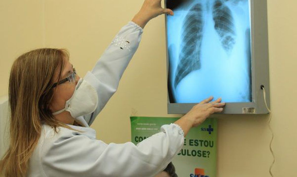 Brasil instala comit&ecirc; interministerial para elimina&ccedil;&atilde;o da tuberculose