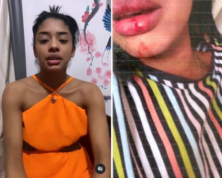 Laudo confirma les&otilde;es em ex-vocalista de banda de forr&oacute; agredida por cantor 
