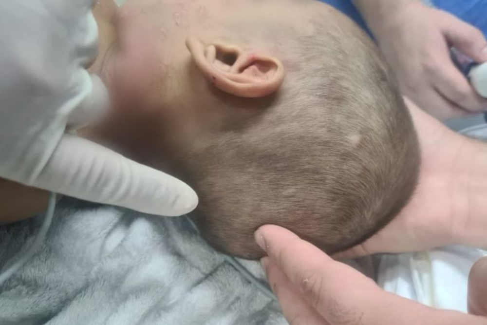 Crian&ccedil;a de 2 anos &eacute; internada em estado grave ap&oacute;s ser espancada pelo tio em Manaus