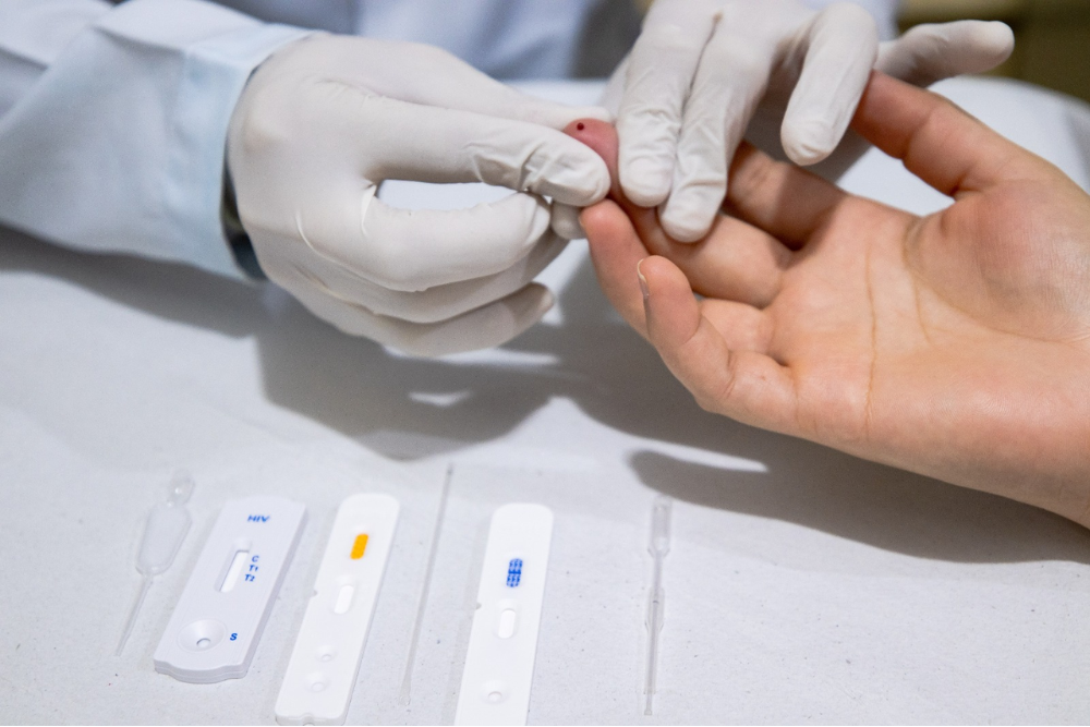 Profilaxia pr&eacute;-exposi&ccedil;&atilde;o ao HIV est&aacute; dispon&iacute;vel em 9 unidades b&aacute;sicas de sa&uacute;de