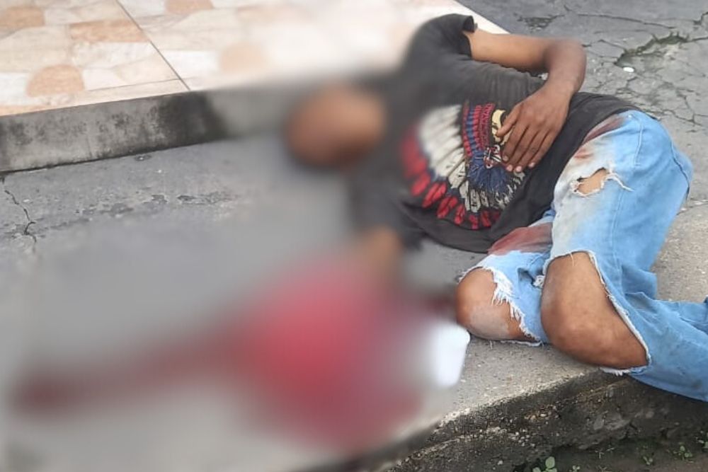 Homem tem mão decepada após ser acusado de roubo no bairro Cidade Nova Homem tem mão decepada após ser acusado de roubo no bairro Cidade Nova