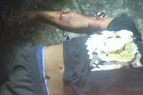 Homem é morto com 17 facadas por causa de dívida no bairro Cidade Nova