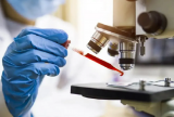 Exame de sangue mostra eficácia no diagnóstico do Alzheimer, indicam estudos