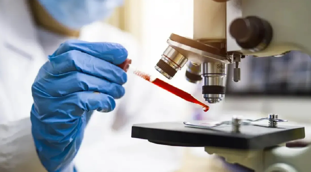 Exame de sangue mostra efic&aacute;cia no diagn&oacute;stico do Alzheimer, indicam estudos