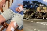 Idoso sobrevive após ficar preso nos escombros de passarela que desabou em Manaus