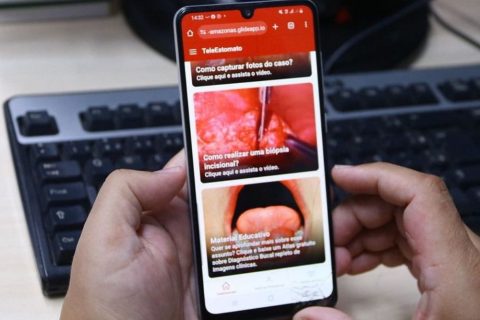 Mais de 35 casos suspeitos de câncer bucal são identificados com ajuda de aplicativo da SES-AM