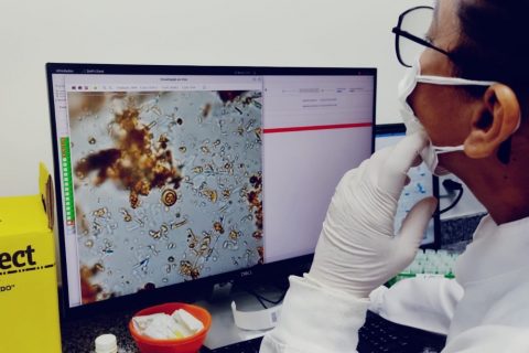 Manaus inaugura novo laboratório automatizado de diagnóstico de parasitas